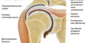 Artroza articulației umărului