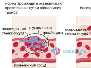 Лекарственный справочник гэотар Что такое фактор виллебранда в крови